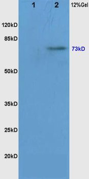 Phospho-RAF1 (Ser338/Tyr340) Rabbit Polyclonal Antibody
