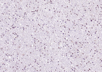RARB Rabbit Polyclonal Antibody