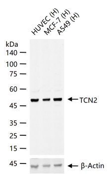 TCN2 Rabbit Polyclonal Antibody