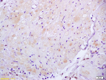 ROCK2 Rabbit Polyclonal Antibody