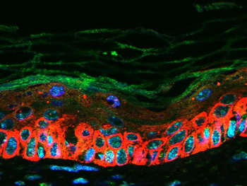 CXCL16 Rabbit Polyclonal Antibody