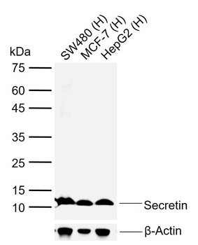 Secretin antibody