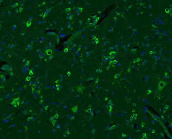 SGCB Rabbit Polyclonal Antibody