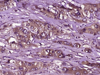 SLC5A1 Rabbit Polyclonal Antibody