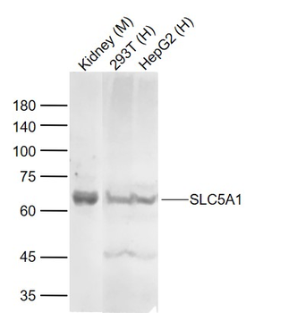 SLC5A1 Rabbit Polyclonal Antibody