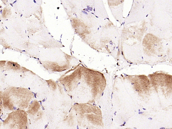 CACNA1S Rabbit Polyclonal Antibody