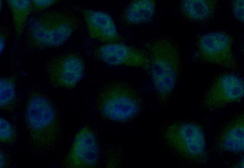 SOD1 Rabbit Polyclonal Antibody