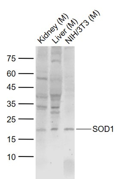 SOD1 Rabbit Polyclonal Antibody