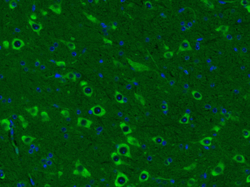 Somatostatin 14/Somatostatin 28 Rabbit Polyclonal Antibody