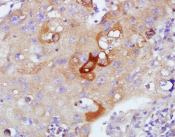 SFTPA1 Rabbit Polyclonal Antibody