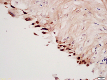 Spindlin 1 Rabbit Polyclonal Antibody