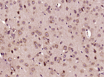 SRF Rabbit Polyclonal Antibody