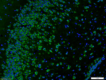 AKAP12 Rabbit Polyclonal Antibody