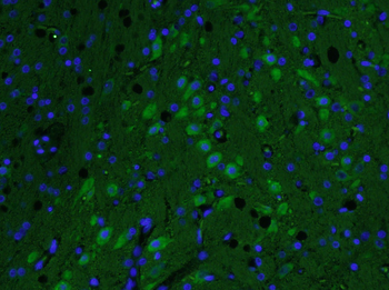 AKAP12 Rabbit Polyclonal Antibody