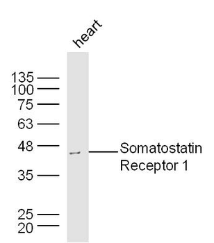 Somatostatin Receptor 1 Rabbit Polyclonal Antibody