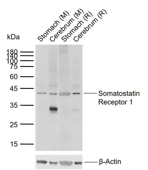 Somatostatin Receptor 1 Rabbit Polyclonal Antibody