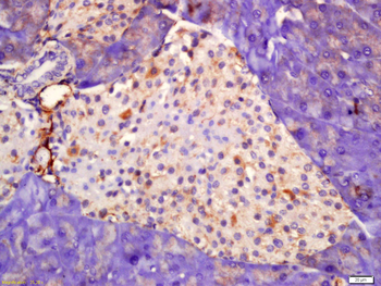 SSTR3 Rabbit Polyclonal Antibody