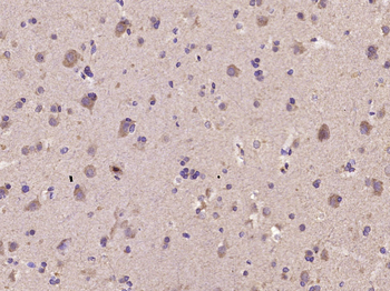 STAT6 Rabbit Polyclonal Antibody
