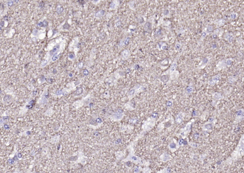 Alpha-Synuclein Rabbit Polyclonal Antibody