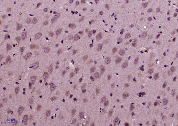 Phospho-Tau (Thr498) Rabbit Polyclonal Antibody