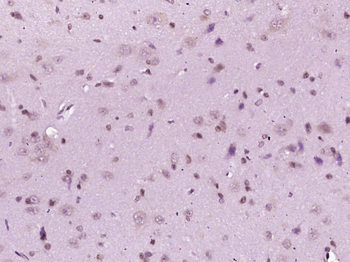 PHLDA1 Rabbit Polyclonal Antibody
