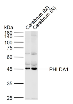 PHLDA1 Rabbit Polyclonal Antibody