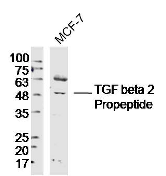 TGF beta 2 Propeptide Rabbit Polyclonal Antibody