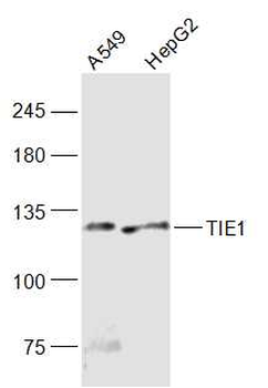 TIE1 Rabbit Polyclonal Antibody