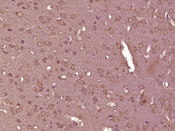 TLR3 Rabbit Polyclonal Antibody