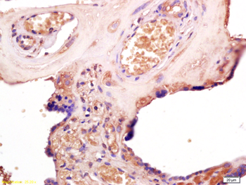 TLR3 Rabbit Polyclonal Antibody