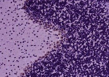 Tenascin C Rabbit Polyclonal Antibody