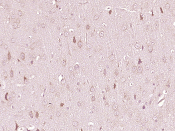 TPH Rabbit Polyclonal Antibody