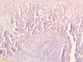 TRAIL Rabbit Polyclonal Antibody