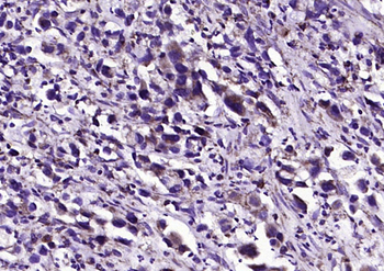 Fumarase/FH Mouse Monoclonal Antibody