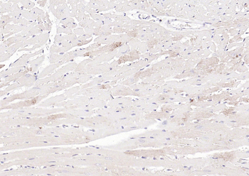 Cathepsin L Rabbit Polyclonal Antibody