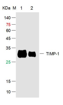 TIMP-1 Rabbit Polyclonal Antibody