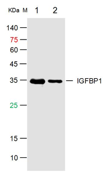 IGFBP1 Rabbit Polyclonal Antibody