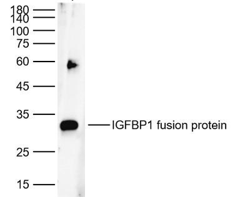 IGFBP1 Rabbit Polyclonal Antibody