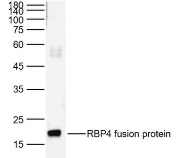 RBP4 Rabbit Polyclonal Antibody