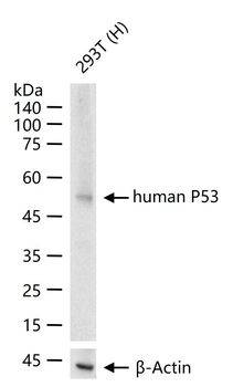 Human P53 Mouse Monoclonal Antibody