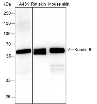 Keratin 6 Recombinant Rabbit Monoclonal Antibody