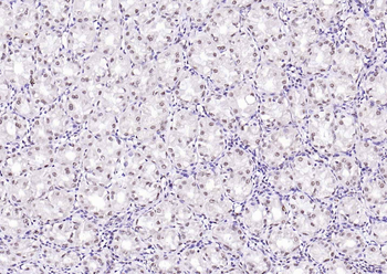 SPHK2 Mouse Monoclonal Antibody
