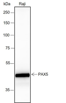 PAX5 Recombinant Rabbit Monoclonal Antibody