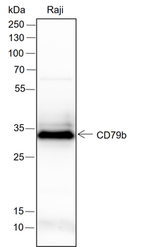 CD79b Recombinant Rabbit Monoclonal Antibody