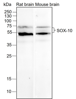 SOX-10 Recombinant Rabbit Monoclonal Antibody
