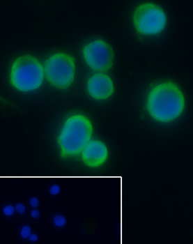 STMN1 Recombinant Rabbit Monoclonal Antibody