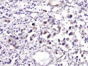 IL-6R alpha Rabbit Polyclonal Antibody