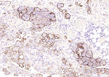 Mesothelin Recombinant Rabbit Monoclonal Antibody
