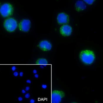 CD22 Recombinant Rabbit Monoclonal Antibody