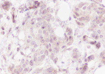 Caspase-7 Recombinant Rabbit Monoclonal Antibody
